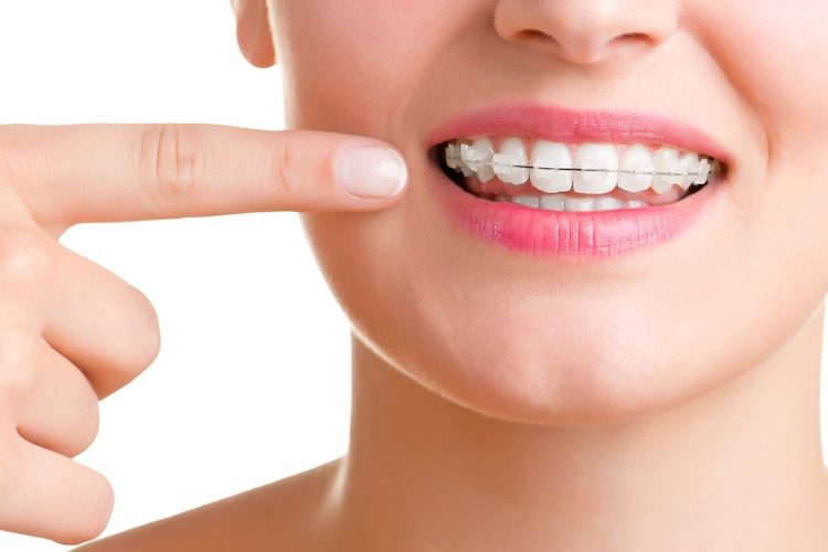 Orthodontic treatment