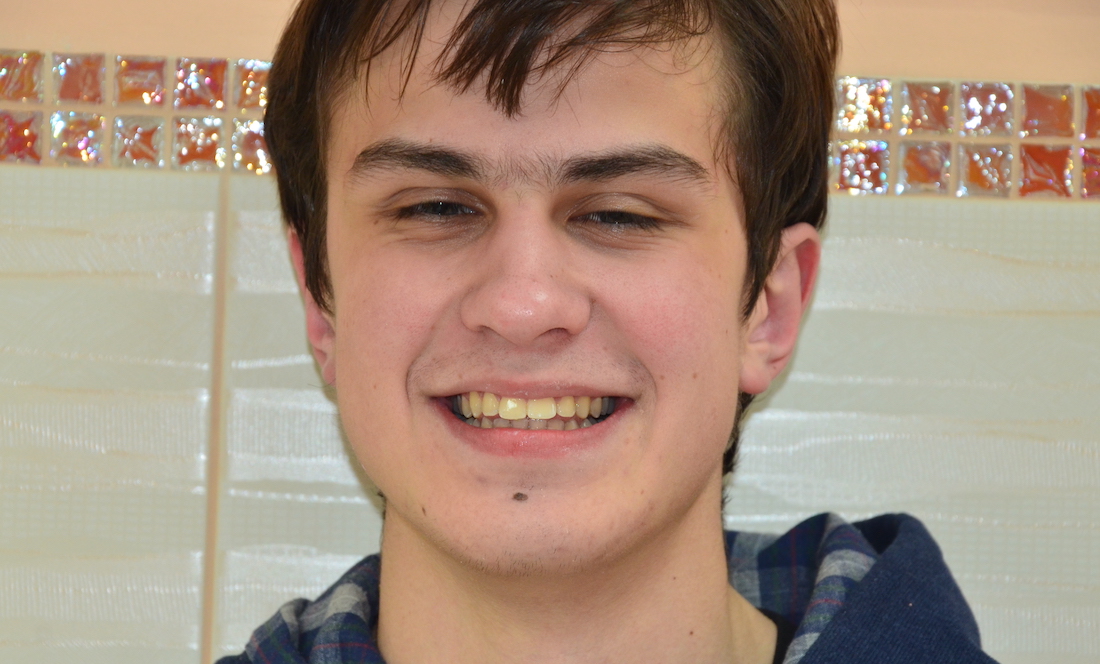 Alignment of teeth with ceramic braces
