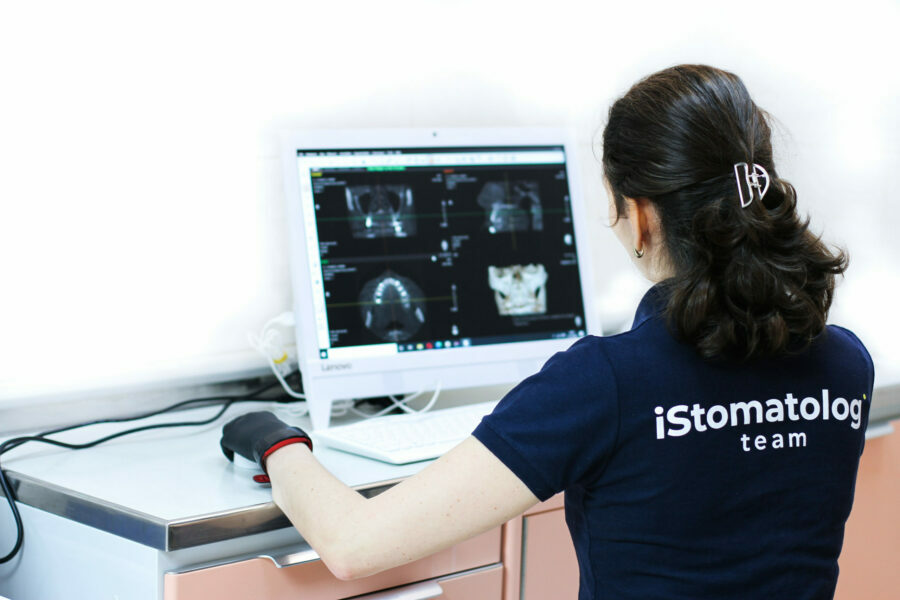 Лікування кісти зуба, періодонтиту, гранульоми, кістогранульоми