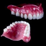 Протезирование при отсутствии всех зубов