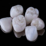 Художественная реставрация зубов