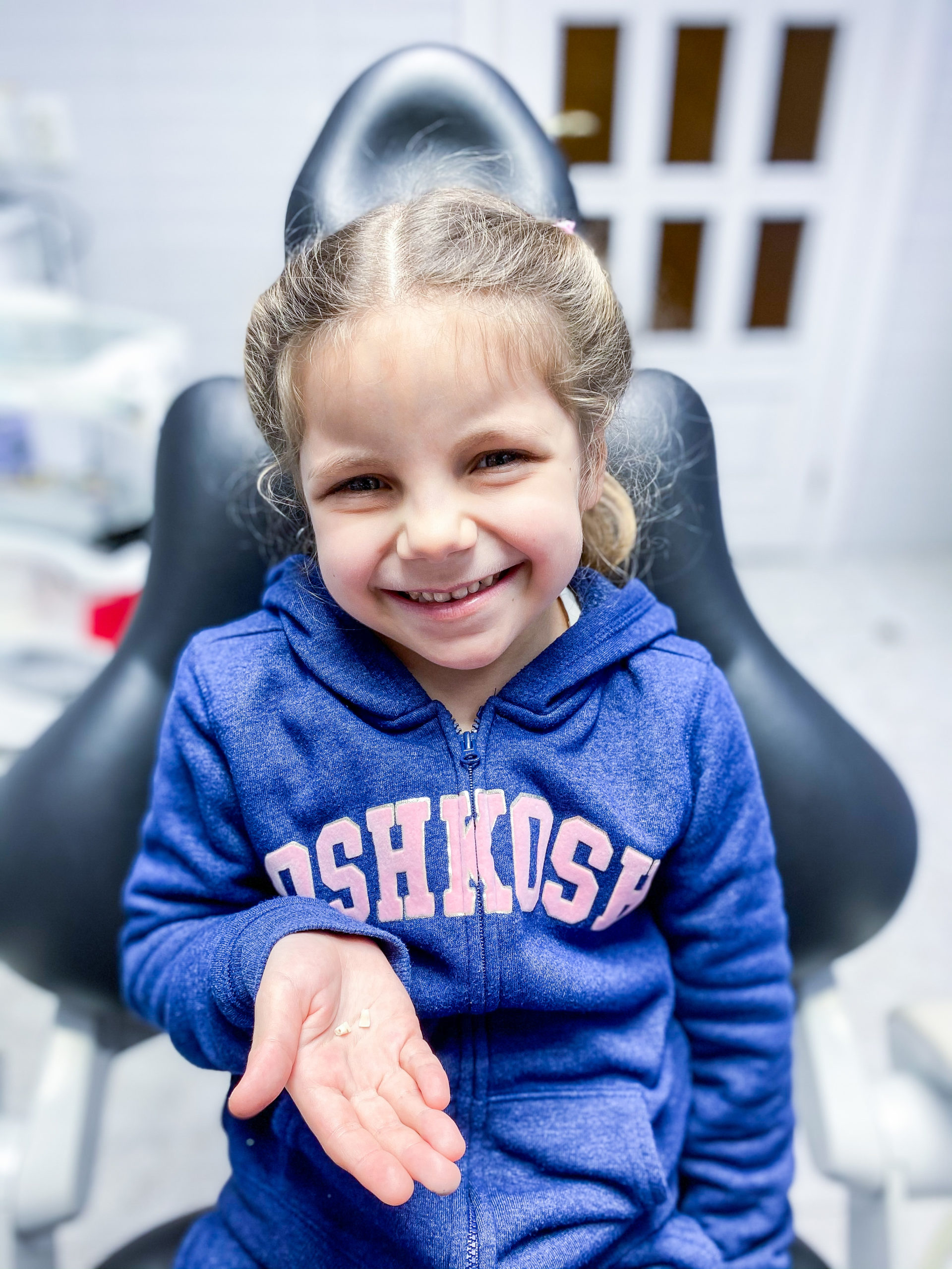 Removal of milk teeth in children Removal of temporary teeth, Kiev