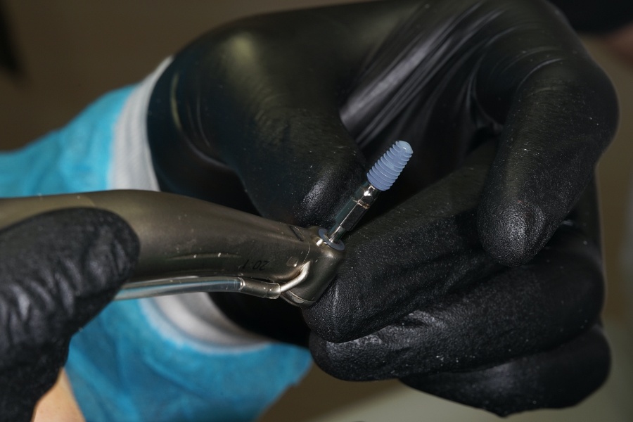 Immediate implantation in Kyiv