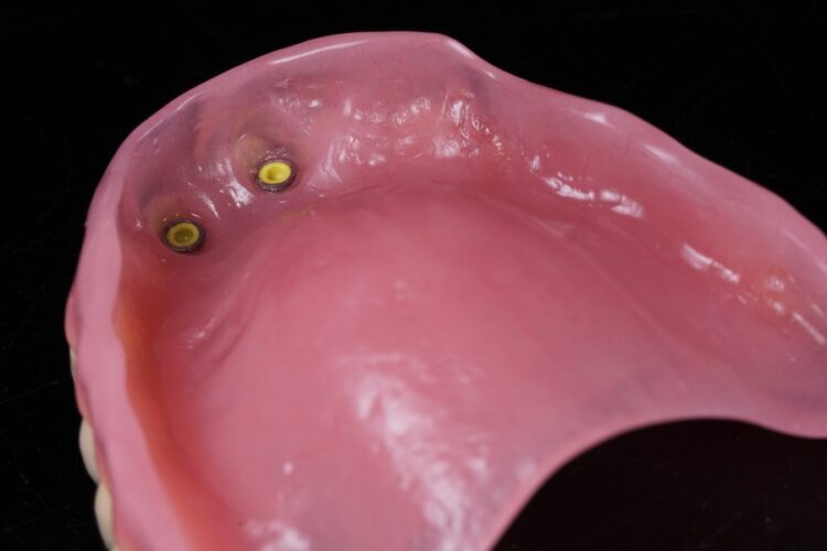 Съемные зубные протезы