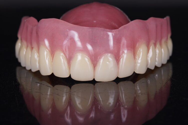 Протезирование при отсутствии всех зубов