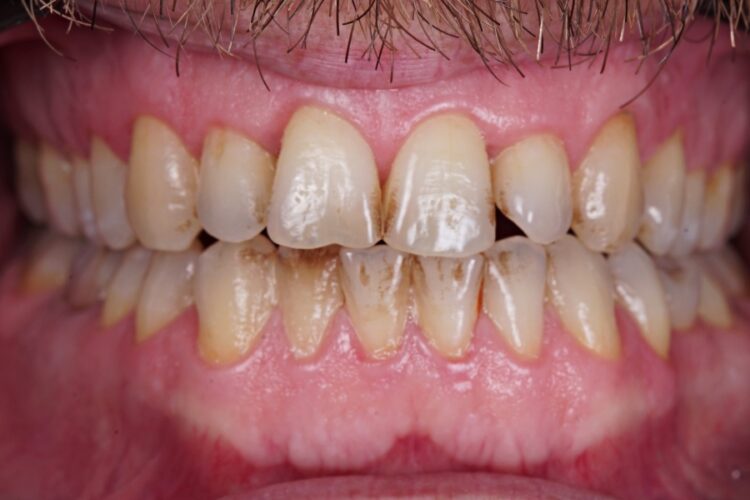 Гігієна ротової порожнини