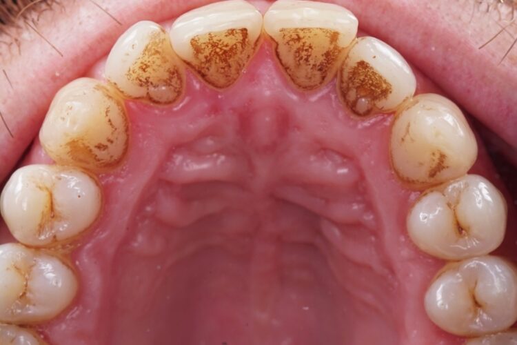 Гігієна ротової порожнини