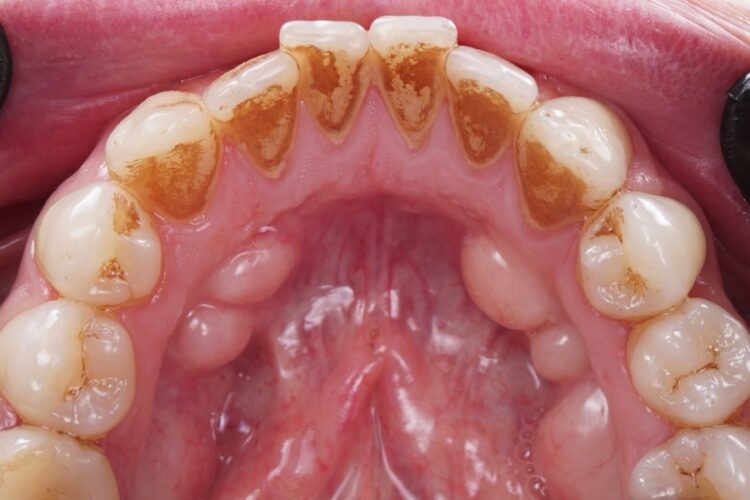 Гігієна ротової порожнини