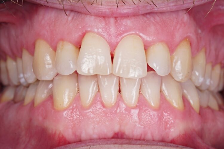 Гігієна ротової порожнини