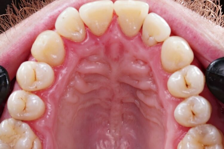 Гігієна ротової порожнини