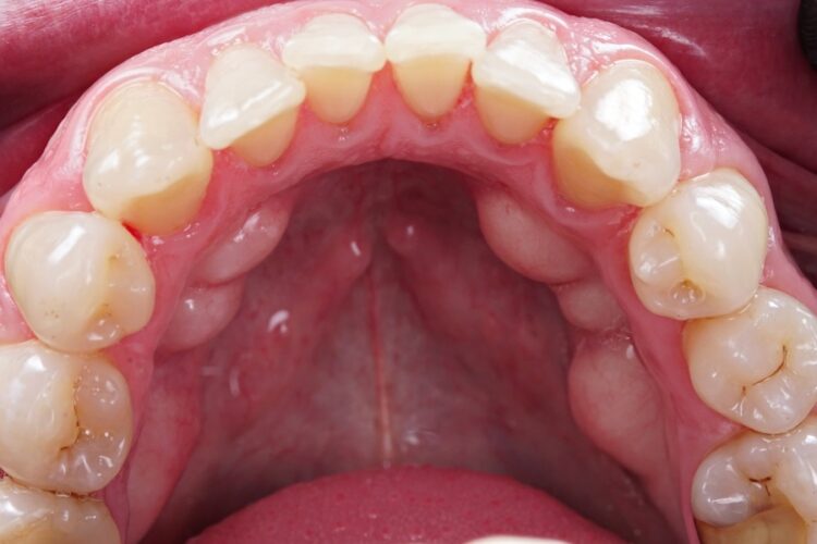 Гігієна ротової порожнини