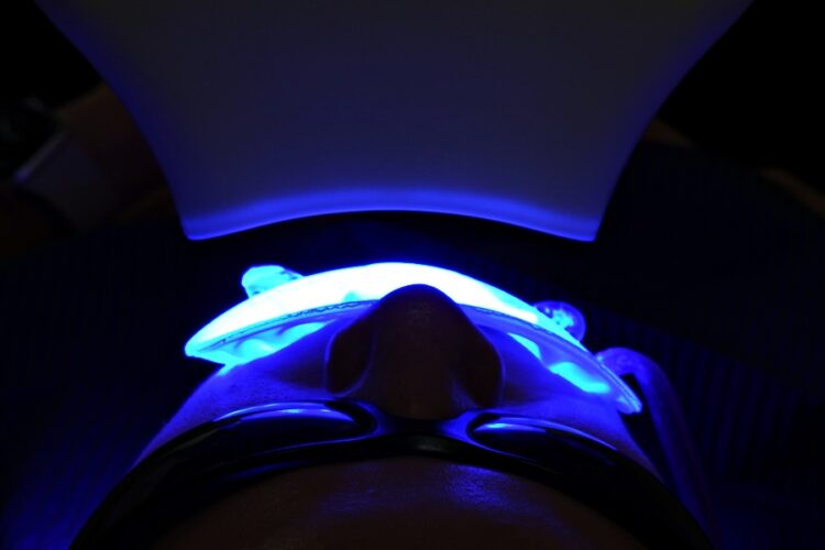 Відбілювання зубів